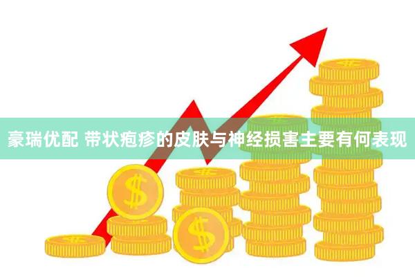 豪瑞优配 带状疱疹的皮肤与神经损害主要有何表现